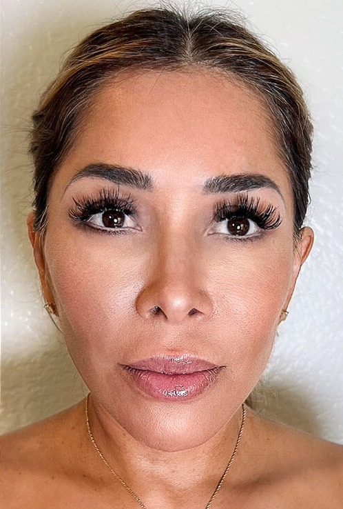 Case--4023 | After Facelift