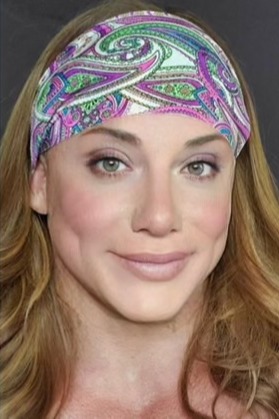 Case--5717 | After Facial Feminization Surgery