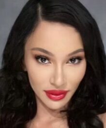 Case--4688 | After Rhinoplasty