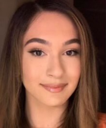 Case--4688 | Before Rhinoplasty