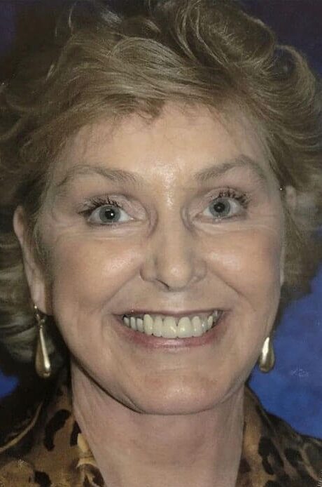 Case--2844 | After Facelift