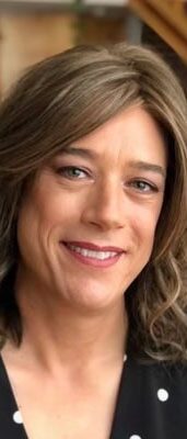 Case--8733 | After Facial Feminization Surgery