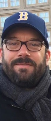 Case--8733 | Before Facial Feminization Surgery