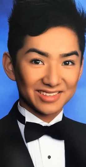 Case--7881 | Before Facial Feminization Surgery