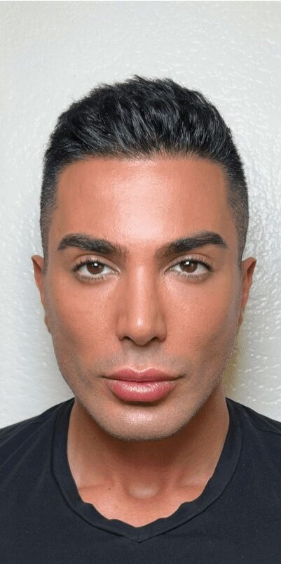 Case--4121 | After Facelift